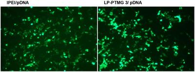 Tight Binding of Plasmid DNA With Self-Assembled Tetramethylguanidinium Conjugated Polyethylenimine Suppresses Transfection Efficiency